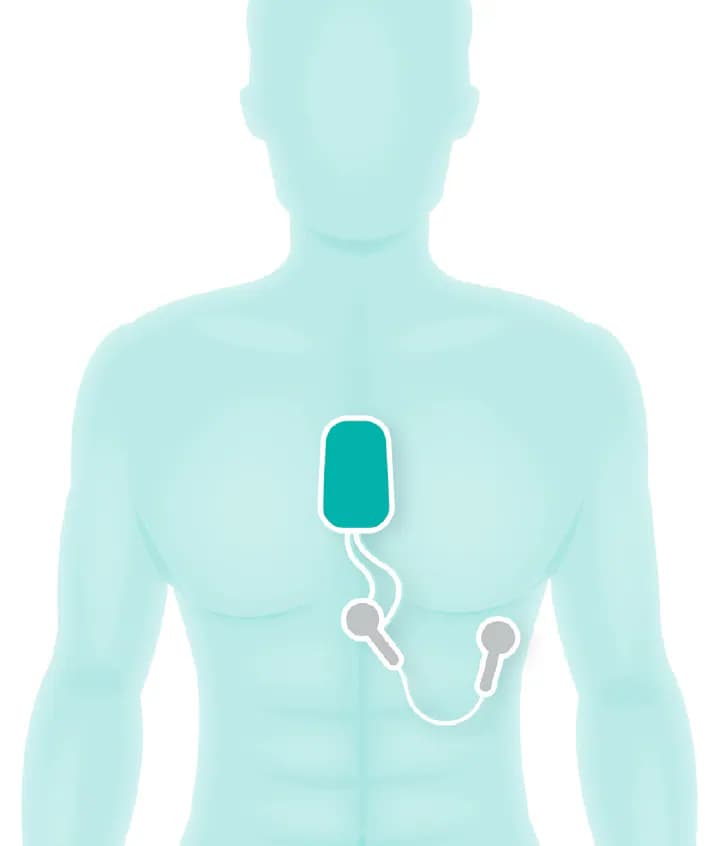 Patient wearing a heart-rate monitor.